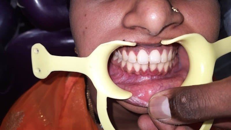 Photos of Singh's dental clinic ( M.D.S- Periodontist) 3