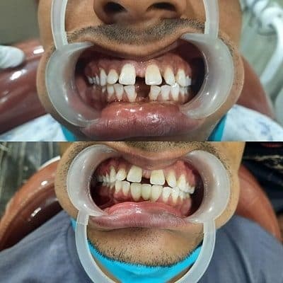 Photos of Dr Idris Holy Dental Clinic 3
