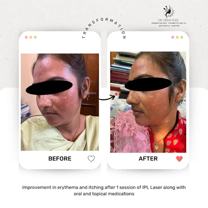 Photos of Dr. Rishi Goel Dermatologist/ Skin & Hair clinic 3