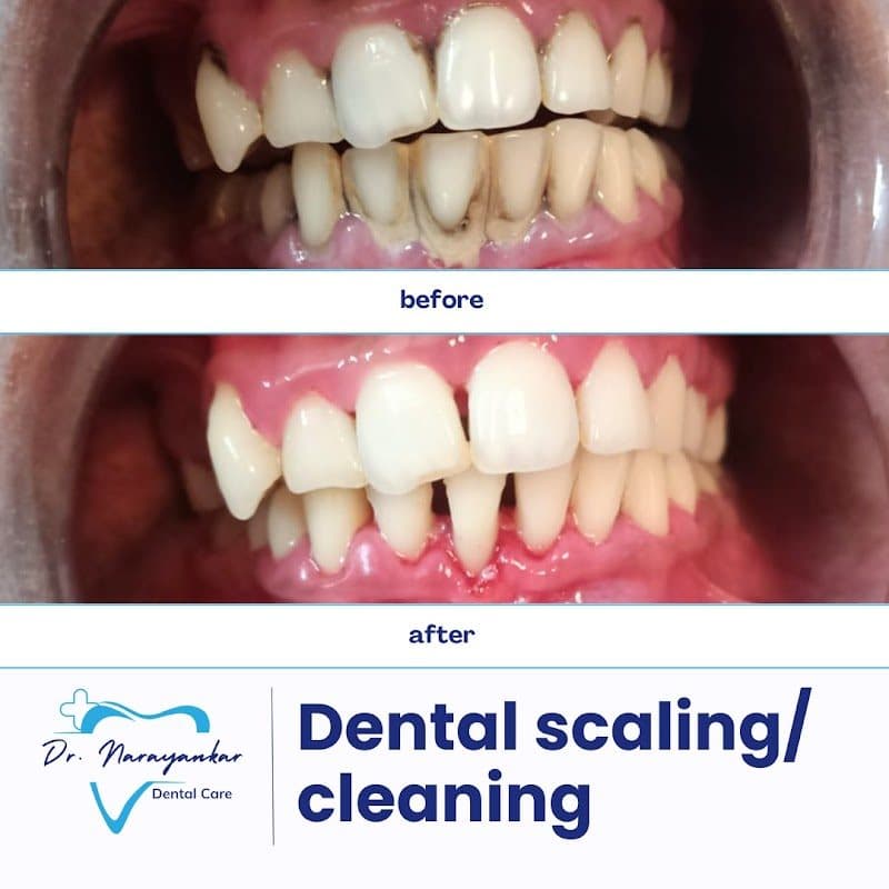 Photos of Dr Narayankar's Dental Care and implant center 3