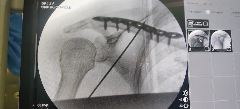 Photos of Dr Joice Varghese M J l Orthopaedic Surgeon l Sports Injuries l Lourdes Hospital 1