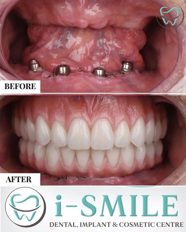 Photos of I Smile clinic 2