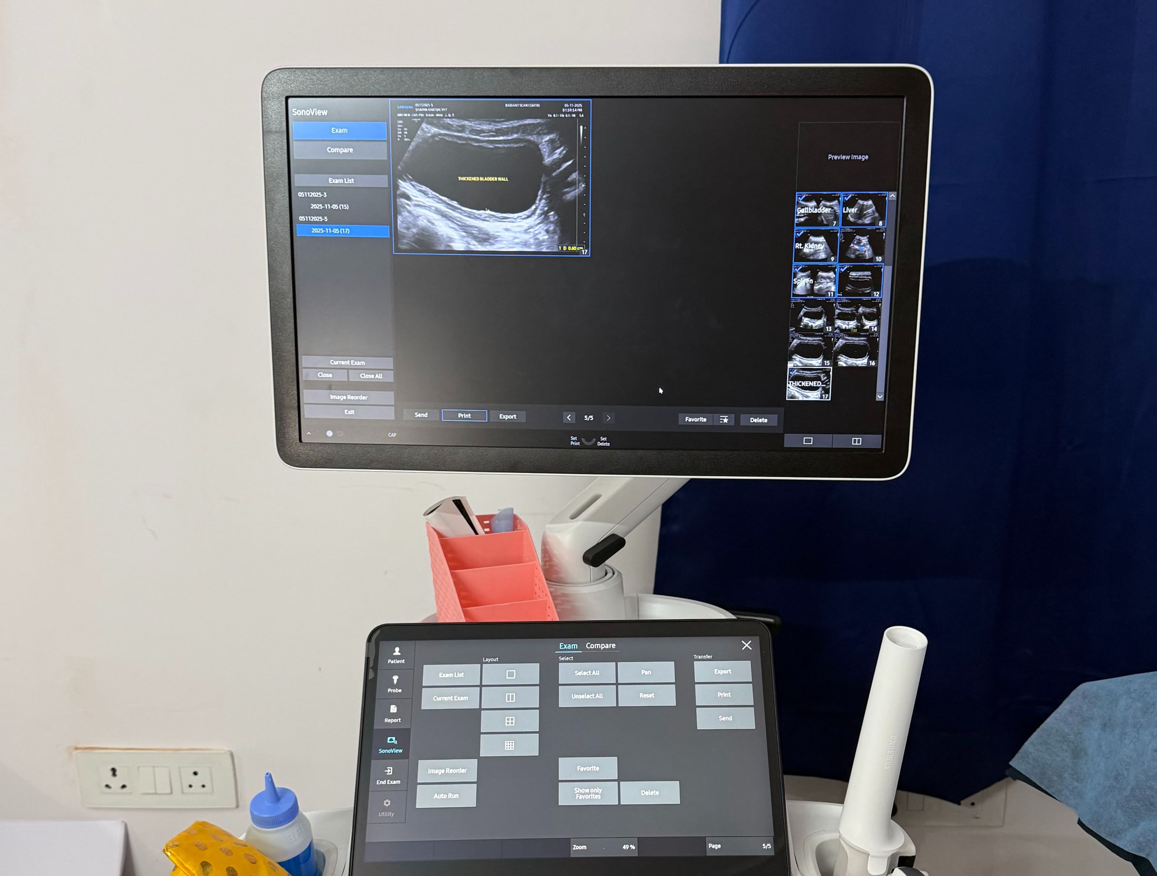 Ultrasound Machine Radiant Scan Center