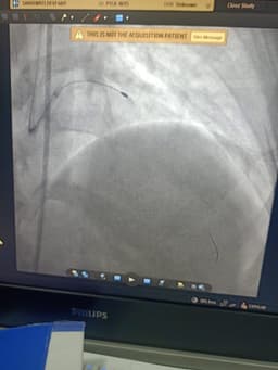 Dr. Krishan Yadav | DM, Cardiologist | Krishna cardiac care | Greater Noida West, UP Dr. Krishan Yadav | DM, Cardiologist | Krishna cardiac care | Greater Noida West, UP