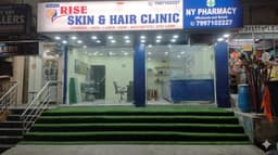 Rise Skin & Hair Clinics | Chaitanyapuri Rise Skin & Hair Clinics | Chaitanyapuri