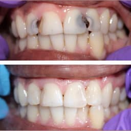 Dr Rahul Banerjee Dental Clinic - Smile Dental Clinic Dr Rahul Banerjee Dental Clinic - Smile Dental Clinic