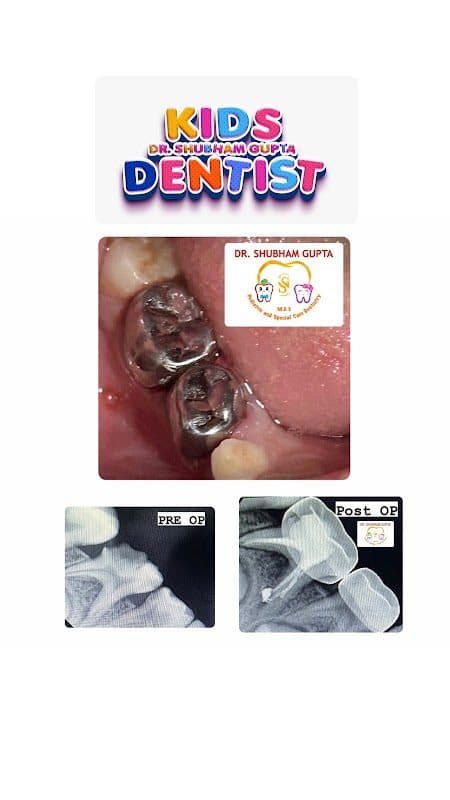 Dr Shubham Gupta (Kids Dentist) Dr Shubham Gupta (Kids Dentist) - Dentist in Durgapur